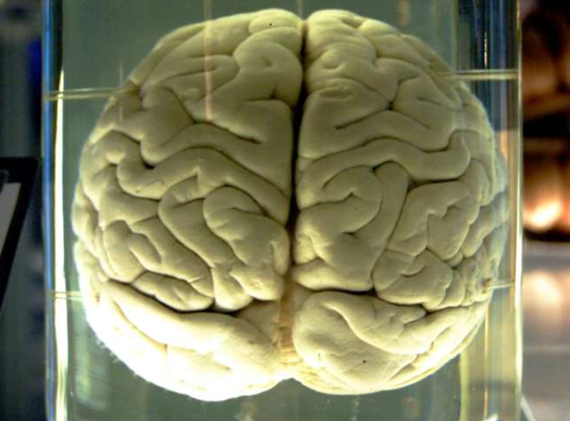 Screenshot_2019-11-02 Overdose de neurosciences cognitives et comportementales.png